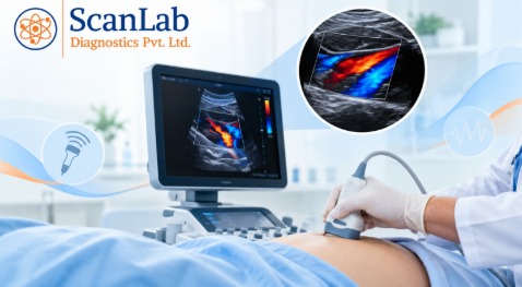 What Does a Colour Doppler Test Check?